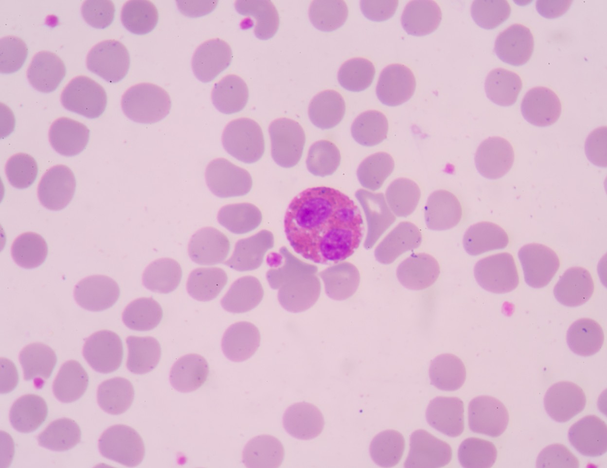 immune cells in Sjogren's