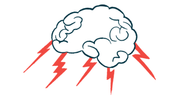 global cognitive impairment | Sjögren’s Syndrome News | brain illustration with lightning bolts