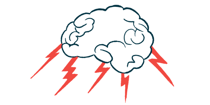 global cognitive impairment | Sjögren’s Syndrome News | brain illustration with lightning bolts