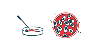 salivary glands and Sjogrens | Sjögren’s Syndrome News | petri dish illustration