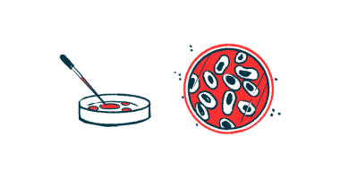 salivary glands and Sjogrens | Sjögren’s Syndrome News | petri dish illustration
