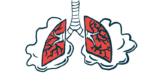 An illustration of lungs struggling to breathe.