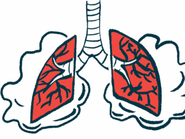 A pair of damaged lungs are seen surrounded by clouds, indicating they re struggling to breathe.