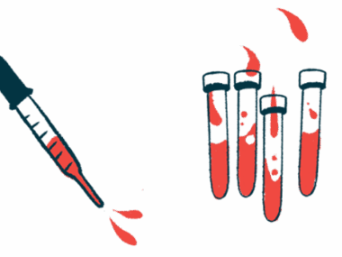 A dropper leans toward vials filled with blood in this illustration.