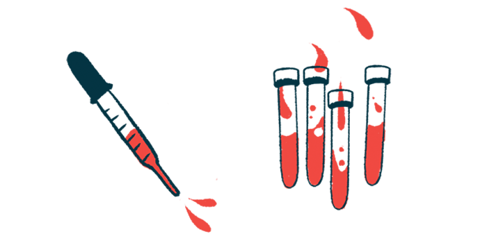 A dropper leans toward vials filled with blood in this illustration.