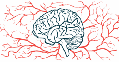 An illustration shows the human brain in profile, surrounded by blood vessels.