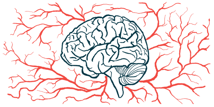 An illustration shows the human brain in profile, surrounded by blood vessels.