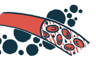 An illustration shows red blood cells flowing through a blood vessel.