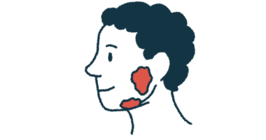 An illustration shows a human head in profile with the salivary glands highlighted.
