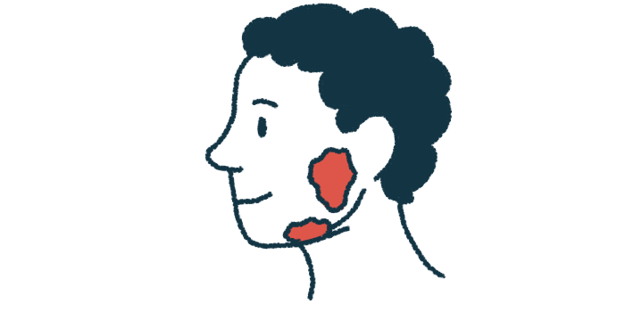 An illustration shows a human head in profile with the salivary glands highlighted.